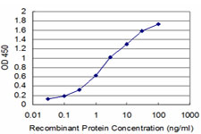 10 - MIB2 Antibody (monoclonal) (M02) AT2868a