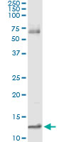 5 - MIF Antibody (monoclonal) (M01) AT2870a