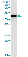5 - MPP1 Antibody (monoclonal) (M01) AT2893a