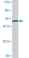 1 - MPPED2 Antibody (monoclonal) (M01A) AT2896a