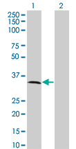 1 - MPPED2 Antibody (monoclonal) (M01A) AT2896a
