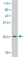 1 - MS4A2 Antibody (monoclonal) (M02) AT2909a