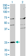 1 - MS4A2 Antibody (monoclonal) (M02) AT2909a