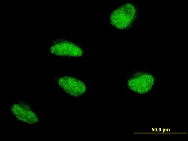 3 - MSH5 Antibody (monoclonal) (M08) AT2911a