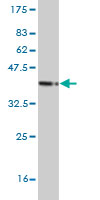 1 - MSH5 Antibody (monoclonal) (M08) AT2911a