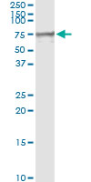 5 - MSLN Antibody (monoclonal) (M02) AT2917a