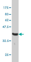 1 - MUTYH Antibody (monoclonal) (M01) AT2939a