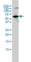 1 - MUTYH Antibody (monoclonal) (M01) AT2939a