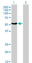 1 - MUTYH Antibody (monoclonal) (M01) AT2939a