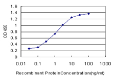 10 - MYL5 Antibody (monoclonal) (M01) AT2953a