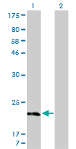 1 - MYL5 Antibody (monoclonal) (M01) AT2953a