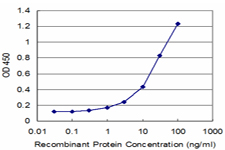 10 - MYL6 Antibody (monoclonal) (M03) AT2955a