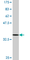 1 - MYL6 Antibody (monoclonal) (M03) AT2955a