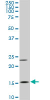1 - MYL6 Antibody (monoclonal) (M03) AT2955a