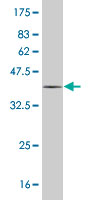 1 - MYL6 Antibody (monoclonal) (M10) AT2956a