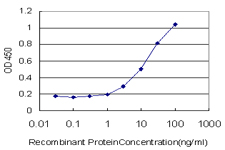 10 - MYO3A Antibody (monoclonal) (M01) AT2958a