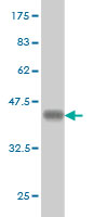 1 - MYO3A Antibody (monoclonal) (M01) AT2958a