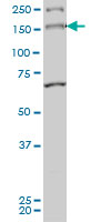 1 - MYO3A Antibody (monoclonal) (M01) AT2958a