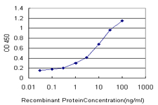 10 - MYO3A Antibody (monoclonal) (M03) AT2959a