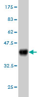 1 - MYO3A Antibody (monoclonal) (M03) AT2959a