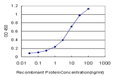 10 - MYOC Antibody (monoclonal) (M01) AT2961a