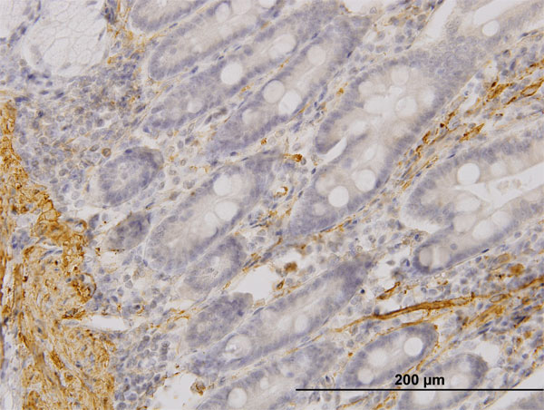 2 - MYOC Antibody (monoclonal) (M01) AT2961a