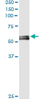 5 - MYOC Antibody (monoclonal) (M01) AT2961a