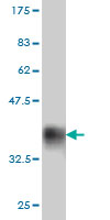 1 - MYOC Antibody (monoclonal) (M01) AT2961a
