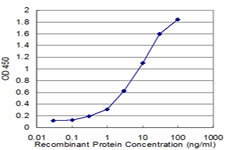 10 - MYOC Antibody (monoclonal) (M02) AT2962a