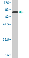 1 - MYOC Antibody (monoclonal) (M02) AT2962a
