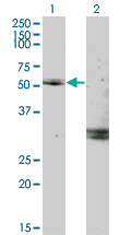 1 - MYOC Antibody (monoclonal) (M02) AT2962a