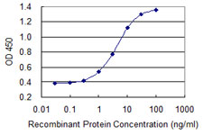 10 - MYOZ1 Antibody (monoclonal) (M05) AT2965a