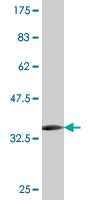 1 - MYOZ1 Antibody (monoclonal) (M05) AT2965a