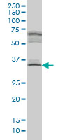 1 - MYOZ1 Antibody (monoclonal) (M05) AT2965a