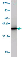 1 - N4BP2 Antibody (monoclonal) (M01) AT2968a