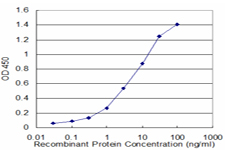 10 - NBR1 Antibody (monoclonal) (M01) AT2977a