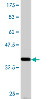 1 - NBR1 Antibody (monoclonal) (M01) AT2977a
