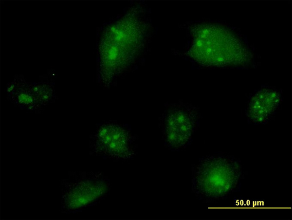 3 - NCOA6 Antibody (monoclonal) (M01) AT2985a