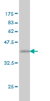 1 - NCOA6 Antibody (monoclonal) (M01) AT2985a