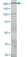 1 - NCOA6 Antibody (monoclonal) (M01) AT2985a