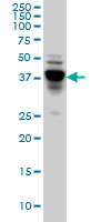 1 - NDRG4 Antibody (monoclonal) (M01) AT2994a