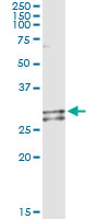 5 - NDUFS3 Antibody (monoclonal) (M02) AT3006a