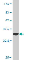 1 - NEK5 Antibody (monoclonal) (M02) AT3018a