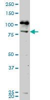 1 - NEK5 Antibody (monoclonal) (M02) AT3018a
