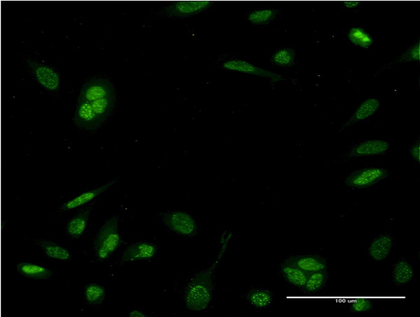 3 - NEUROD6 Antibody (monoclonal) (M06) AT3024a