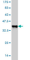 1 - NFE2L2 Antibody (monoclonal) (M03) AT3031a