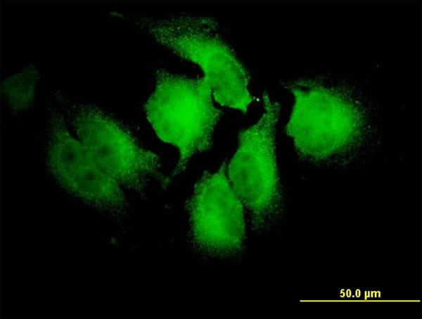 3 - NOTCH2NL Antibody (monoclonal) (M01) AT3079a