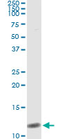 5 - NPPB Antibody (monoclonal) (M01) AT3086a