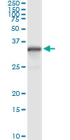 5 - NQO1 Antibody (monoclonal) (M01) AT3089a