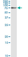 5 - NRP1 Antibody (monoclonal) (M05) AT3115a